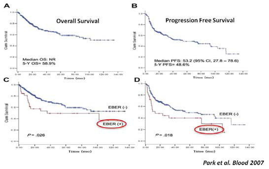 EBV (+) DLBCL 환자 생존율