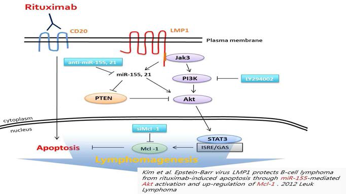 LMP1 발현 시 CD20 의 표적 치료제 Rituximab 처리 시 유도된 항암 내성 기전