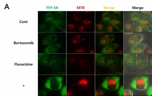 Flunarizine과 bortezomib 병합처리 시 소포체 및 미토콘드리아 구조 변화