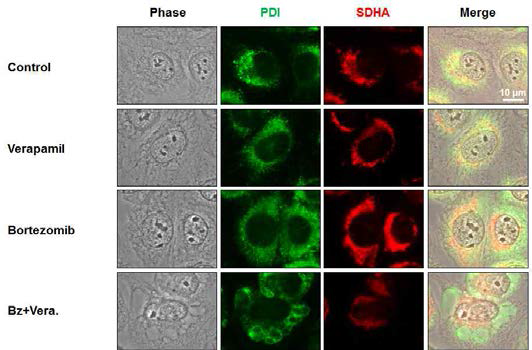 Verapamil과 bortezomib 병합처리 시 소포체 팽창 관찰