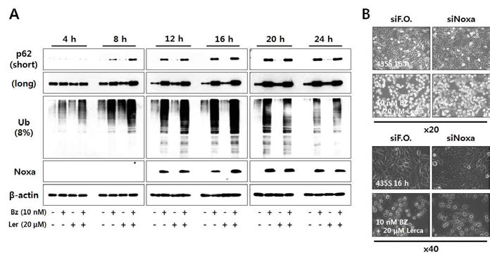 Lercanidipine과 bortezomib 병합처리에 의한 proteasome 활성 변화 및 Noxa의 역할