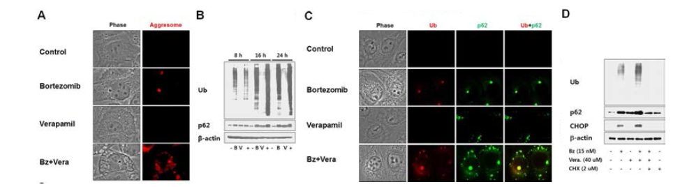 Verapamil과 bortezomib 병합 처리에 의한 paraptosis-like cell death 과정 중 aggresome 제어 분석