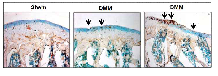 DMM 골관절염 모델 동물에서 DMM 수술에 의한 연골조직에서 MMP-13의 발현 확인