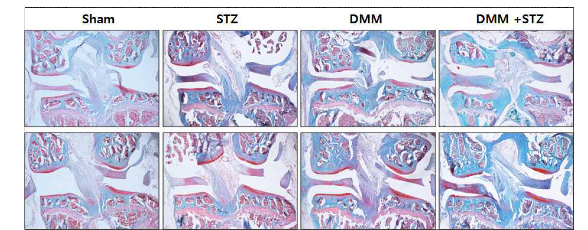 DMM 유도 골관절염 마우스에서 STZ 투여로 당뇨를 유발한 후에 연골 손상 확인