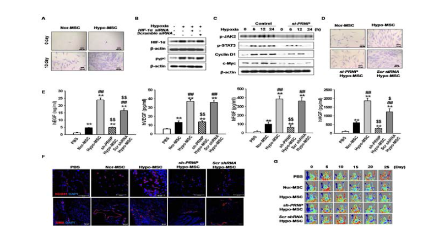 저산소 조건 배양 시 중간엽 줄기세포의 증식력이 증가를 Single cell colony assay 기법을 이용하여 확인함. 또한 저산소 조건 배양에서 줄기세포내에 증가한 cellular prion protein(PrPC)은 HIF-1alpha에 의해 조절되었으며 중간엽 줄기세포의 증식에 영향을 미치는 것으로 확인함. 특히 PrPC는 중간엽 줄기세포의 self-renewal 능력을 조절하는 것을 PRNP (PrPC) siRNA 처리를 통해 확인함. 하지허혈 동물 모델 제작 후 저산소 배양한 중간엽 줄기세포를 이식 후 이식 부위의 혈관 형성 관련 세포성장 인자 발현을 확인한 결과 저산소 배양한 중간엽 줄기세포 그룹에서 발현이 가장 높았으며, 혈관으로의 분화분포를 (CD31, SMA) 면역형광 염색법을 이용해 확인한 결과 저산소 배양한 중간엽 줄기세포 그룹이 유의성 있게 혈관 형성을 증가시켰고 이 증가함을 확인하였고, 저산소 배양에 의해 증가된 PrPC가 혈관 형성에 관여하고 있음을 shRNA법을 이용하여 확인함