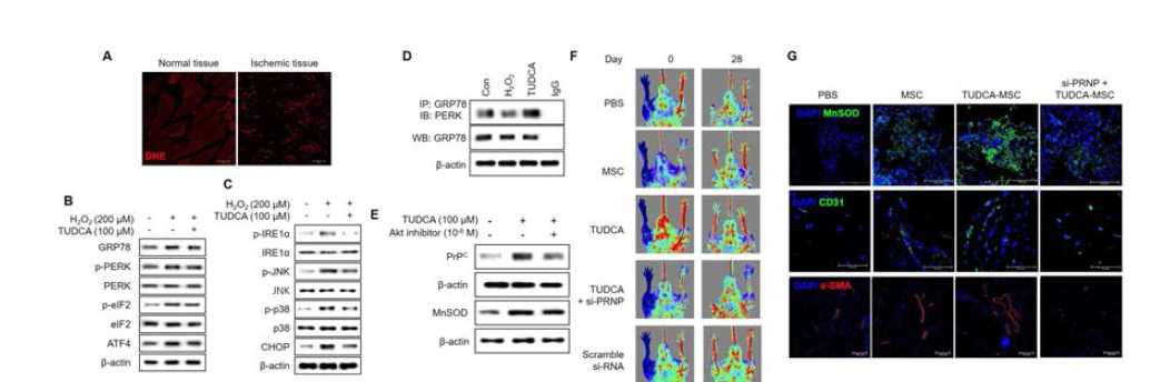 마우스 하지허혈 동물 모델의 질환 부위를 DHE 염색을 통해 산화성 스트레스 발생을 확인한 결과 허혈질환 부위에서는 높은 활성산소가 생성되었으며, 특히 허혈 질환 부위 조직에서는 ER 스트레스 관련 인자 단백질 (PERK, eIF2, ATF4, IRE1alpha, CHOP) 의 발현이 증가함. TUDCA의 전처리는 중간엽 줄기세포 내의 GRP78과 PERK 단백질 결합을 통해 ER 스트레스를 유도하는 unfolding protein 의 축적을 감소시킴. 특히 TUDCA는 AKT 신호전달 및 PrPC의 발현을 통해 항산화 효소인 MnSOD의 발현을 유도함. TUDCA 전처리된 중간엽 줄기세포를 하지허혈 동물 모델에 이식 했을 경우 혈류량 회복 및 혈관 형성을 촉진하였으며, MnSOD의 발현을 증가시킴. 하지만 PrPC의 발현을 siRNA를 통해 억제했을 경우 치료효과가 감소하여 TUDCA가 PrPC를 통해 줄기세포의 치료효과를 증진시키는 것을 확인함
