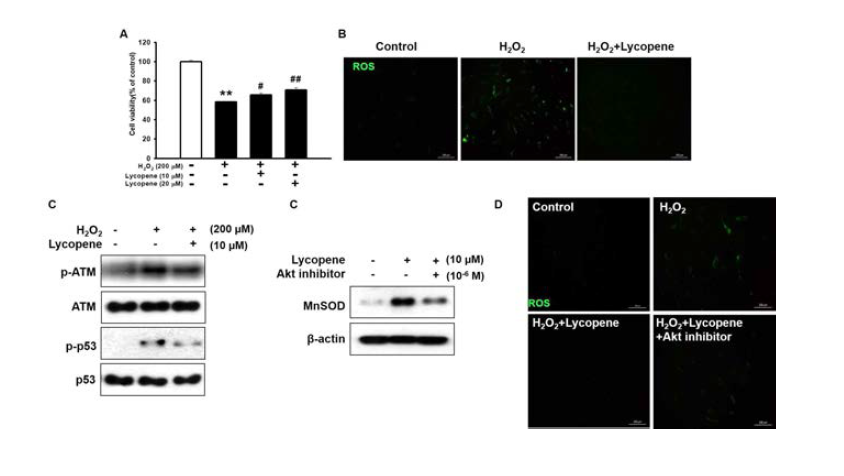 Lycopene은 중간엽 줄기세포에 발생한 산화성스트레스로부터 세포사멸을 방어하고 활성산소를 감소시키는 것을 MTT assay와 DCF-DA 염색을 통해 확인함. 특히 Lycopene은 산화성 스트레스에 의한 DNA 손상을 감소시키는 것을 ATM, P53 단백질 인산화를 통해 검증함. 또한 Lycopene은 중간엽 줄기세포의 AKT 신호전달계를 통해 항산화 효소인 MnSOD의 발현을 조절하고 있음을 확인하였고 DCF-DA 염색을 통해 Lycopene의 AKT 신호전달을 통한 ROS 감소 효과를 확인함