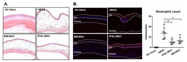 Histological analysis of the cornea. (A) Hematoxylin-eosin staining of the cornea demonstrated stromal edema and inflammatory cell infiltration on day 7 after injury in the HBSS-treated mice, compared to the cornea without injury. By contrast, stromal swelling and inflammatory infiltration were reduced in the cornea of mice treated with iPSC-MSCs or BM-MSCs. (B) Immunohistochemistry for neutrophil revealed dense neutrophilic infiltration of the cornea after injury, and neutrophil infiltration was markedly reduced by iPSC-MSCs or BM-MSCs. Original magnification x200. Epi: corneal epithelium. Stroma: corneal stroma