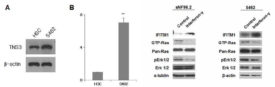 정상의 Schwann 세포주(HSC)와 NF1 악성종양 Schwann 세포주(sNF96.2, S462)에서의 TNS3 단백질(A) 및 mRNA(B) 발현량 비교
