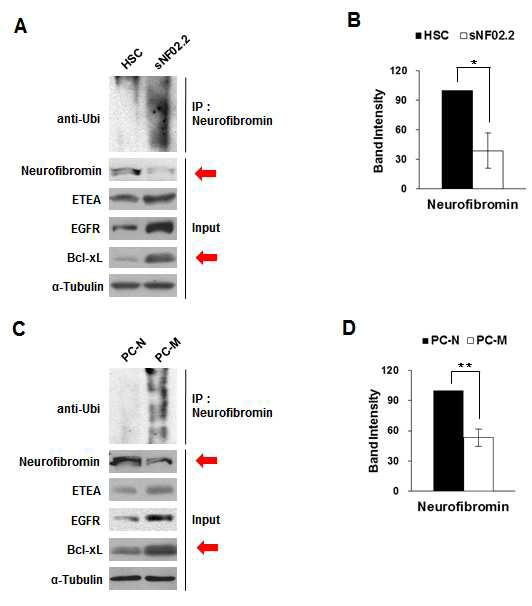NF1 악성세포에서의 Neurofibromin의 ubiqutination 분석 (HSC: 정상 Schawann 세포주; sNF02.2: NF1 악성 Schawann 세포주; PC-N :정상 primary 세포; PC-M: 악성 primary 세포)