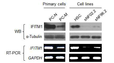 NF1 환자유래 primary 세포와 NF1 세포주에서의 IFITM1 발현량 (PC-N: 정상세포, PC-M: 악성세포, HSC: 정상 Schawann 세포주, sNF02.2/sNF96.2: NF1 악성세포주)