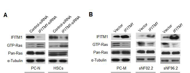 NF1 환자유래 primary 세포와 NF1 세포주에 IFITM1 발현저해(siRNA)와 과발현(overexpression)시의 RAS 활성화(GTP-RAS) 분석 (PC-N: 정상세포, PC-M: 악성세포, HSC: 정상 Schawann 세포주, sNF02.2/sNF96.2: NF1 악성세포주)
