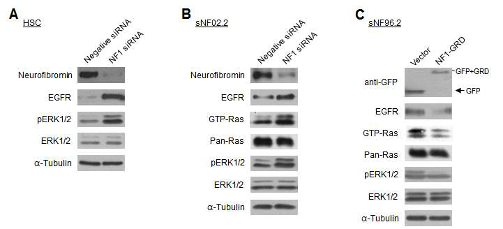 NF1 세포주에서 NF1 발현저해(NF1 siRNA)와 과발현(NF1-GRD)시의 EGFR 발현량, RAS 활성화(GTP-RAS), ERK1/2 활성화(phospho-ERK1/2) 분석(HSC: 정상 Schawann 세포주, sNF02.2/sNF96.2: NF1 악성 세포주; NF1-GRD: NF1 유전자에서 GRD(GAP related domain) 부분만 cloning한 construct)