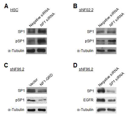 NF1 세포주에서 NF1 발현저해(NF1 siRNA)와 과발현(NF1-GRD)이 SP1 발현량과 활성화 (Phospho-SP1)에 미치는 영향(HSC: 정상 Schawann 세포주, sNF02.2/sNF96.2: NF1 악성 Schawann 세포주; NF1-GRD: NF1 유전자에서 GRD(GAP related domain) 부분만 cloning한 construct)