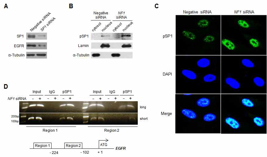 NF1 세포주에서 NF1 발현저해(NF1 siRNA)에 의한 EGFR의 발현증가와 SP1의 핵 이동과의 영향