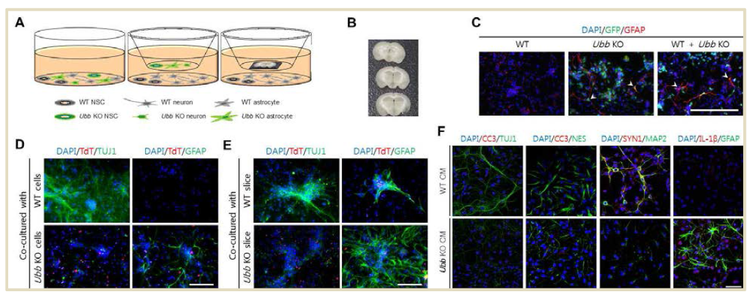 Ubb 결손 세포 또는 뇌절편과 공동배양한 WT 신경세포의 표현형