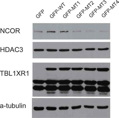 TBL1XR1의 발현에 따른 세포내의 NCOR, HDAC3의 발현정도 조사