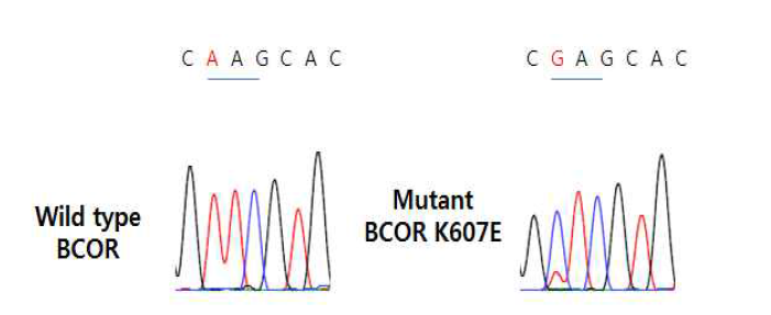 BCOR의 정상과 돌연변이 유전자 서열의 분석결과