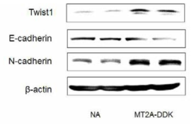 Expression of E-cadherin and N-cadherin in MCF-7 transfected with MT2A-DDK.The cells were lysed and the total protein was assessed by western blot. The western blot analyses were performed for each sample using antibodies specific for human E-cadherin, N-cadherin and β-actin