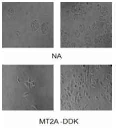 Morphological change in MCF-7 transfected with MT2A-DDK