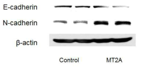 Expression of E-cadherin and N-cadherin in MCF-7 transfected with MT2A-DDK. The cells were lysed and the total protein was assessed by western blot. The western blot analyses were performed for each sample using antibodies specific for human E-cadherin, N-cadherin and β-actin