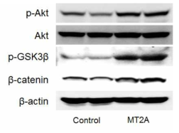 Expression of p-Akt, p-GSK3β, and β-catenin in MCF-7 transfected with MT2A-DDK. The cells were lysed and the total protein was assessed by western blot. The western blot analyses were performed for each sample using antibodies specific for human p-Akt, p-GSK3β, β-catenin and β-actin