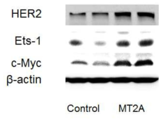 Expression of HER2, Ets-1, and c-Myc in MT-2A overexpressin MCF-7. The cells were lysed and the total protein was assessed by western blot. The western blot analyses were performed for each sample using antibodies specific for human HER2, Ets-1, c-Myc and β-actin