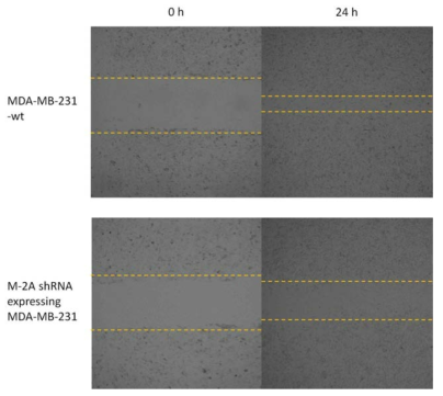 Effect of MT-2A down-regulation on cell motility. Cell monolayers were scratched with a 100μL pipette tip to make a wound. Cells were then incubated with media for 24 h. Images were taken at the end points and compared to 0 h to measure wound healing