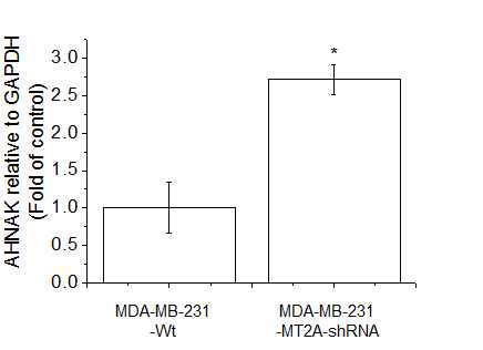 Expression of AHNAK in MDA-MB-231-wt and MDA-MB-231(MT-2A KD). The cells were lysed and the total mRNA was analyzed by real time-PCR. PCR amplification was performed for each sample using primers specific for human Vimentin and ZEB1 . *p < 0.05 compared with MDA-MB-231-wt