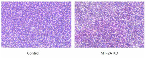 H&E staining of the tumors of MDA-MB-231 and MT-2A knockdown MDA-MB-231 xenograft groups
