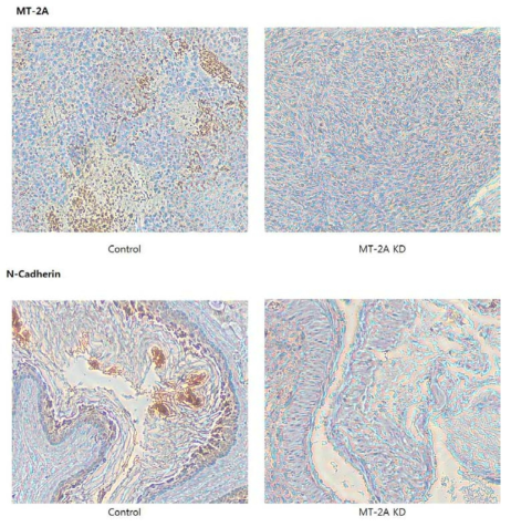 Immunohistochemistry of MT-2A and N-cadherin in the tumors of MDA-MB-231 and MT-2A knockdown MDA-MB-231 xenograft groups