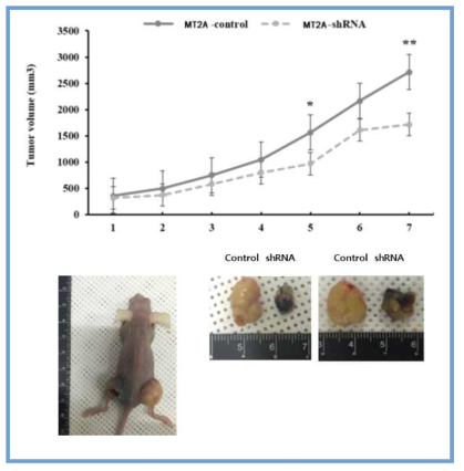 Effect of MT-2A on the growth of the tumors in breast cancer patient-derived xenograft model