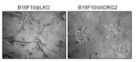 DRG2 발현 억제된 B16F10 세포의 배양액이 endothelial cell의 tube-formation에 미치는 영향