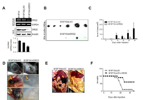 DRG2 발현 억제에 의한 B16F10 melanoma cell의 성장 및 전이 억제. A, shRNA를 사용하여 DRG2 발현이 억제된 B16F10 세포주 제조. 대조구로써 empty vector를 transfection한 세포 제조. B, C, and D, 앞에서와 같이 제조한 세포를 mouse에 sc 주사 후 15일 째 형성된 primary tumor size. E, 허파, 간 등의 장기에 전이. F. B16F10 세포 주사후 mouse survival curve