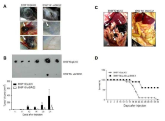Knock down of DRG2 expression in melanoma cells impairs tumorigenesis and metastasis and enhances survival. Representative pictures of the tumors from C57BL mice s.c injected with B16F10/pLKO and B16F10/shDRG2. Defects in primary tumor formation (A and B), metastasis (C) and enhanced survival (D)