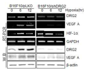 DRG2 depletion does not inhibit the expression of HIF1 in melanoma cells