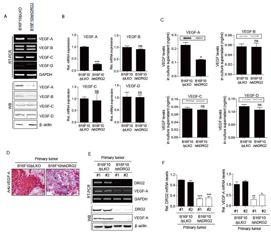 DRG2 depletion inhibits the expression of VEGF-A in melanoma. (A-C) DRG2 depletion decreases the expression of VEGF-A in B16F10 cells. Control and DRG2-depleted B16F10 cells were cultivated under hypoxic condition for 12 h. The levels of VEGF-A, VEGF-B, VEGF-C, and VEGF-D in the cell lysates were determined by semi-qRT-PCR (A, top), Western blot (A, bottom), and qRT-PCR (B). The levels of VEGF-A, VEGF-B, VEGF-C, and VEGF-D in the cell supernatant of control and DRG2-depleted B16F10 cells were determined by immunoprecipitation (C, top) and ELISA (C, bottom). Data are presented as the mean±SD (n=3) (*p<0.05; ***p<0.001). (D-F) DRG2 depletion decreases the levels of VEGF-A in melanoma tumor. Control and DRG2-depleted B16F10 tumors were collected at day 28 after sc injection and analyzed for VEGF-A by IHC staining with anti-VEGF-A antibody (D), qRT-PCR (E), and Western blot (F). Data are presented as the mean ± SD (n=3) (*p<0.05; **p<0.01; ***p<0.001). (G and H) The supernatants of DRG2-depleted melanoma cells shows defect in in vitro tube formation in murine endothelial cell line SVEC4-10. The culture supernatants were collected from control and DRG2-depleted B16F10 cells cultivated under hypoxic condition. SVEC4-10 cells were incubated for 24 h with the supernatants. Recombinant VEGF-A (40 ng/ml) was used as a positive control. (G) Representative images of tube formation by SVEC4-10 cells stimulated with recombinant VEGF-A or the supernatant of melanoma cells. (H) Quantification of the length of tubes. Data represents the total tube length from each of four randomly chosen fields and mean ± SD of three independent experiments. *p<0.05; ***p<0.001