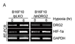 Induction of DRG2 by Hypoxic condition in B16F10 melanoma cells
