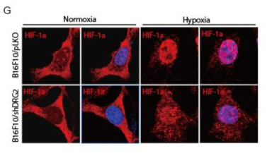 DRG2 does not affect the expression level of HIF-a but affect nuclear localization of HIF-a under hypoxic condition