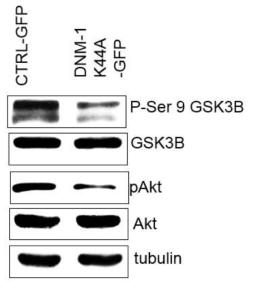 blocking of endocytosis by using dynamin mutant reverses the Akt/GSK-3b signal in DRG2-depleted cells