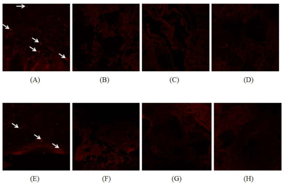 Expression of MHC I (A-D) and II (E-H). The expression of MHC I (A) and II (E) in fresh nasal septal cartilage is observed (arrows). However, there is no expression of MHC I (B-D) and II (F-H) in cartilage flakes made with the freezing and grinding method before detergent treatment (B, F) and after 1% Triton X-100 (C, G) and 2% SDS (D, H)