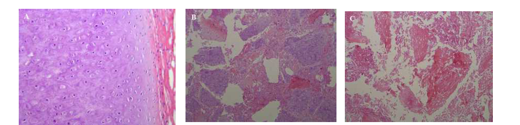 Size analysis and general morphologic analysis of procine cartilage flakes. (A) Normal lacunae with viable mature chondrocytes were well observed in fresh cartilage tissue. (B) Although freezing and grinding process was done, normal lacunae with viable mature chondrocytes were still observed. (C) After 1% Triton X-100 treatment, empty lacunae without viable cell nuclei were seen in the irregular cartilage flakes. (HE stain, X 200)