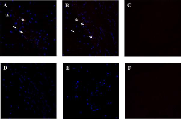 Confocal microscopic findings to assess the MHC class I and II antigen expression according to the decellularization process. (A) Bright red spots (white arrows) indicates the MHC class I antigen. MHC class I antigens are observed in the fresh xenogenic cartilage flakes before freezing and grinding. (B) After freezing and grinding of cartilage flakes without 1% Triton X-100 treatment, MHC class I antigens are still present. (C) After decellularization process with 1% Triton X-100, the expression of MHC class I antigen is not observed. (D-F) MHC class II antigen is not expressed in the fresh cartilage tissue, cartilage flakes, and detergent treated cartilage flakes at all