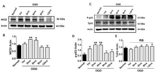 Primary Cortical Neuron에서의 Oxygen Glucose Deprivation 시간에 따른 NICD 및 인산화된 p53의 단백질 양 분석