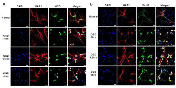 Primary Cortical Neuron에서의 Oxygen Glucose Deprivation 시간에 따른 NICD 및 인산화된 p53의 단백질 양 분석