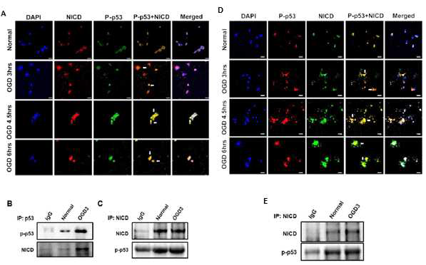 OGD조건에서 NICD와 P-p53 단백질의 co-localization 및 Immunoprecipitaion을 통한 단백질 결합 확인, SH-SY5Y neuroblastoma 세포(왼쪽)과 Primary cortical neuron(오른쪽)