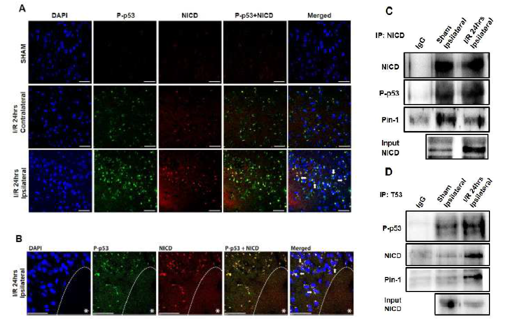 In vivo 뇌졸중 모델에서 NICD와 P-p53의 세포 내 위치 및 상호작용