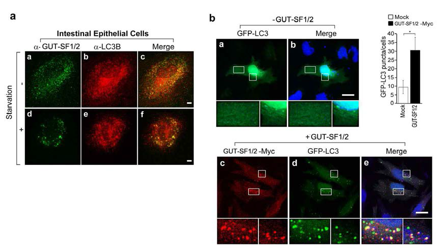 GUT-SF1/2의 세포내에서 LC3 단백질과 colocalization 되는 것을 관찰