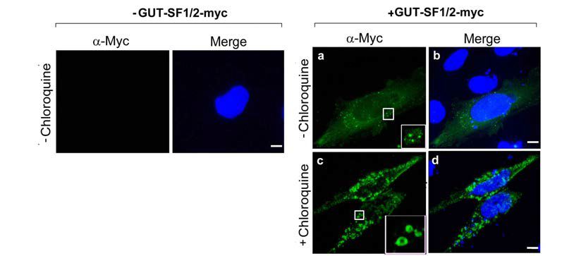리소좀 저해제에 의한 GUT-SF1/2 유도 자가포식포 변화 관찰
