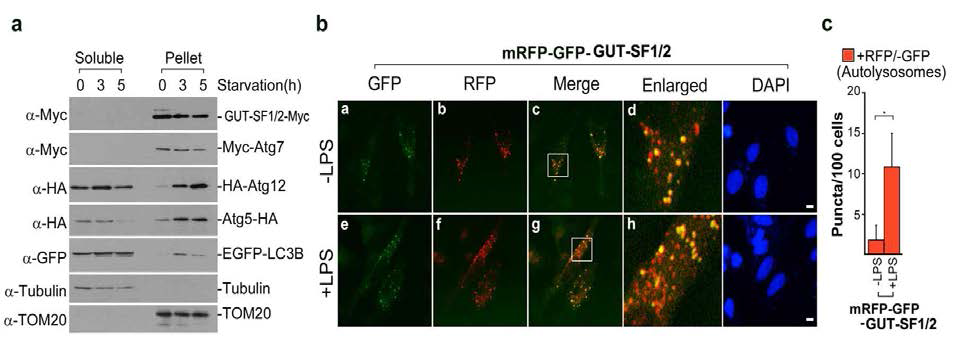 LPS 자극에 의한 GUT-SF1/2 유도 자가포식작용 관찰